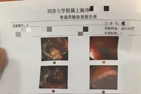 “狂炫”30多颗，痛到无法忍受！医生建议：喝可乐图片