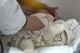 出生三个月 黄疸依旧不退 背后的原因竟是？图片