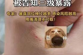 小伙用嘴帮女友吸伤口，不料悲剧了……当事人：千万别学我图片