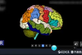 山东首家！青岛医院引入DeepSeek大模型，将有哪些变化？图片