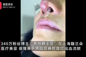 花8万整驼峰鼻，被整成骆驼鼻，340万粉丝的贵州网红哭诉：整容医院不管我图片