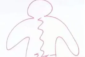 腰痛部位不同，原因不同，看看您的腰痛在哪里？图片
