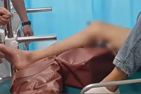 骨科求助！高空跌落，男子腿部被钢筋无情贯穿图片