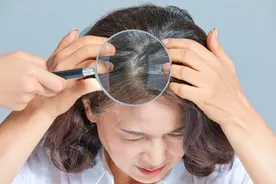 你的白发比同龄人多，可能是身体缺这4种营养~图片