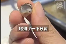 成都一顾客吃火锅时吃出牙齿？相关部门回复：系顾客本人脱落的金属烤瓷牙冠套图片