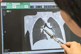 咳咳咳……孩子久咳不愈，不是病毒不是细菌，竟是因为它图片