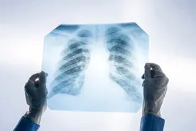 千万级体检数据报告显示：近半人群存在超重、肺结节、甲状腺结节情况图片