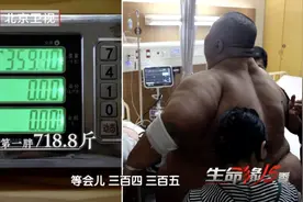 “中国第一胖”躺货车进京就医，减重300多斤！曾一顿吃25个包子……图片
