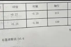 护眼变伤眼！这个“热敷神器”很多人都在用，教你科学护眼方法图片