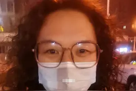 为什么劝你“过年前，千万不要烫头”？看完这些对比，你就明白了图片