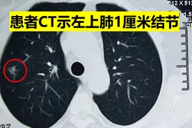 啥是早期肺癌？预后好吗？需要术后化疗吗？胸外科专家告诉你图片