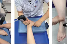 远程康复督导结合冲击波治疗在踝关节术后康复中的应用 | 科技导报图片