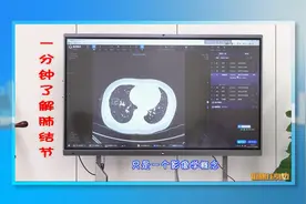 健康在身边丨一分钟了解肺结节图片