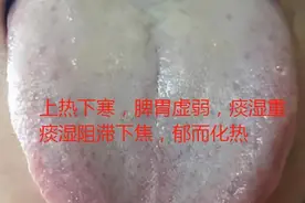 这种上热下寒的舌象，舌根虽然舌苔黄腻，先要区别湿热下注！图片