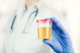 尿液像水一样清澈，说明健康吗？医生忠告：这5种颜色要小心图片