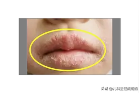 冬天孩子容易内热，一碗小甜水，一清热，二润燥，孩子少生病！图片