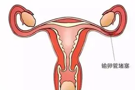 走进子宫内膜异位症，白给的知识图片