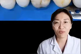  为什么都说补牙特别疼呢？#口腔健康 #口腔科普 #爱护牙齿 #医学科普 #健康科普 #牙齿健康 #牙医日常 #补牙 @抖音短视频 视频封面