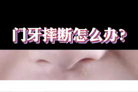 不是所有孩子都这么幸运，能补救的我们要积极采取措施##口腔健康 #育儿 #门牙 #孩子 #父母必看系列 #补牙 #口腔科普 视频封面