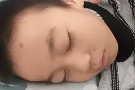 小孩儿身上起的水泡红点儿是啥？还有很强的传染性视频封面