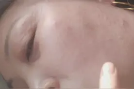 吃菠萝过敏啦视频封面