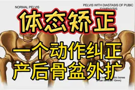 【自我矫正】 一个动作纠正产后骨盆外扩，耻骨联合分离，假胯宽视频封面