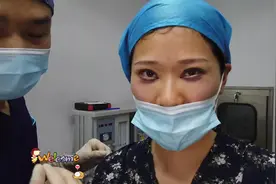 双眼皮小肉条适当修薄些 内外两侧松皮适当祛除 眼综合即刻效果视频封面