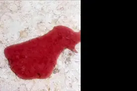 猫咪突然吐血带去医院检查竟是便秘引起？惨遭灌肠至今无法释怀视频封面