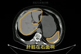 #CT腹部检查 手把手带你看CT腹部影像视频封面