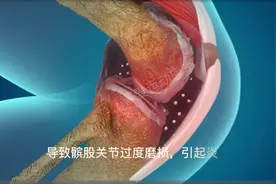 如何正确使用跑步机，这次亲自下场做科普了，谢谢各位支持😂视频封面