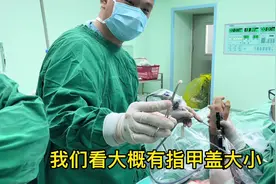 关节内取骨块#骨科 #手术 #健康视频封面