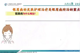 广西医科大学第一附属医院皮肤性病科的皮皮，跟大家分享#银屑病视频封面