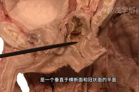 男性盆腔矢状面 #医学科普 #医学科普 #知识科普 #解剖视频封面