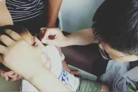 广州8岁男童被确诊为全球首例白瞳症患者，家中宠物未驱虫感染！#全球首例 #宠物 #孩子健康 视频封面
