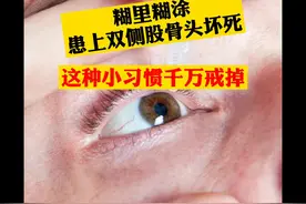 有些滴眼液含有糖皮质激素，不能长期使用#医学科普 #骨关节疼痛视频封面