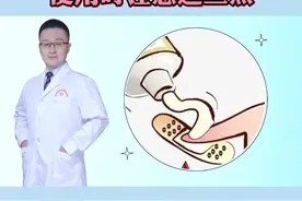 #维A酸乳膏 使用时要注意这三点#医学科普 #皮肤