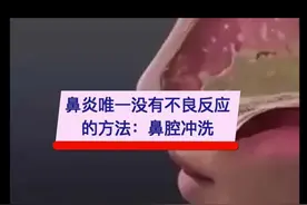 不管什么类型的#鼻炎 ，各国指南都推荐生理盐水鼻腔冲洗视频封面