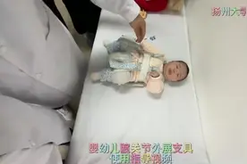 婴幼儿髋关节外展支具视频封面