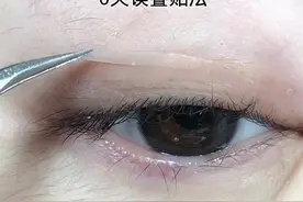 单眼皮眼皮松弛的叠贴法#双眼皮贴 #双眼皮贴教程视频封面