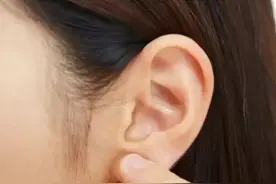 耳垂里有疙瘩，捏着疼#耳垂#耳洞瘢痕疙瘩#皮脂腺囊肿#健康3000问 @小荷医典 视频封面