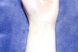 我好像是三条，快看看你的是几条。