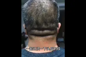 认识头后面的纹#养生就是养健康 #喜欢就关注我吧 #好物推荐🔥视频封面