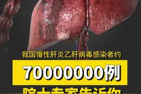 我国慢性肝炎乙肝病毒感染者约70000000例，院士专家教你怎么防治肝炎 #乙肝视频封面