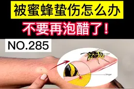 被蜜蜂蜇伤，科学处理很重要，别再泡醋了！#蜜蜂 #医学科普 #健康科普 #科普 #涨知识 视频封面