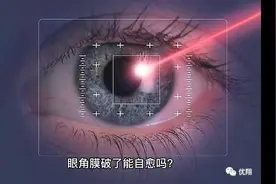#知识分享 眼角膜破了能自愈吗？视频封面
