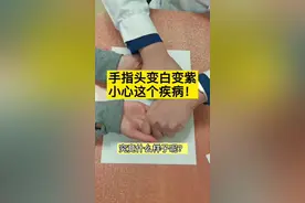 手指头变白变紫小心这个疾病！#健康真相官 #医学科普视频封面
