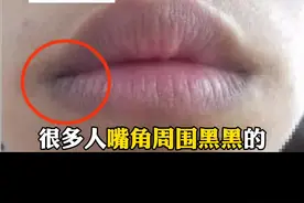 这个视频记得转给你的#女朋友 看看，嘴角黑黑的，其实也不是什么大问题。#皮肤 #变白 #科普 视频封面