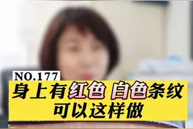 你们身上有这种红、白条纹吗？#科普 #肥胖纹 #情侣 #胖 视频封面
