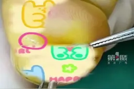 手机膜碎要警惕！#女子被钢化膜碎片扎手后长出瘤。#广西