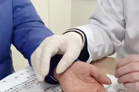 这位患者双手发麻是怎么回事#医学知识科普 #医学科普 #骨科视频封面